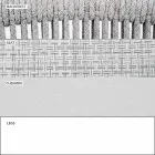 Garden Lounge Sessel Polsterstoff und Aluminium - Smart von Varaschin Viadurini